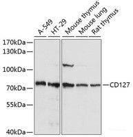 Western blot analysis of extracts of various cell lines using CD127 Polyclonal Antibody at dilution of 1:1000.