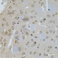 Immunohistochemistry of paraffin-embedded Mouse brain using Snail Polyclonal Antibody