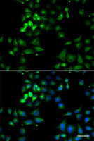 Immunofluorescence analysis of A549 cells using HYOU1 Polyclonal Antibody
