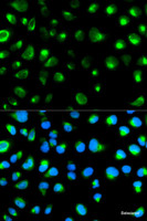 Immunofluorescence analysis of MCF-7 cells using GYPC Polyclonal Antibody