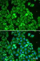 Immunofluorescence analysis of HeLa cells using STAT1 Polyclonal Antibody