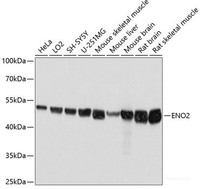 Western blot analysis of extracts of various cell lines using ENO2 Polyclonal Antibody at dilution of 1:3000.