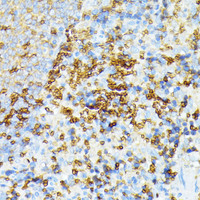 Immunohistochemistry of paraffin-embedded Rat spleen using SPTA1 Polyclonal Antibody at dilution of 1:100 (40x lens) .