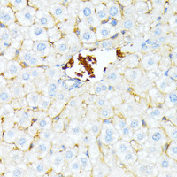 Immunohistochemistry of paraffin-embedded Mouse liver using SPTA1 Polyclonal Antibody at dilution of 1:100 (40x lens) .