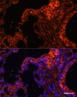 Immunofluorescence analysis of Mouse lung cells using SPTA1 Polyclonal Antibody at dilution of 1:100. Blue: DAPI for nuclear staining.