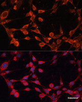 Immunofluorescence analysis of NIH/3T3 cells using SLC25A19 Polyclonal Antibody at dilution of 1:100. Blue: DAPI for nuclear staining.