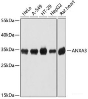Western blot analysis of extracts of various cell lines using ANXA3 Polyclonal Antibody at dilution of 1:3000.
