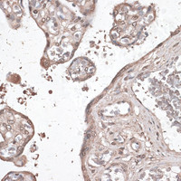 Immunohistochemistry of paraffin-embedded Human placenta using MEF2C Polyclonal Antibody at dilution of 1:100 (40x lens) .