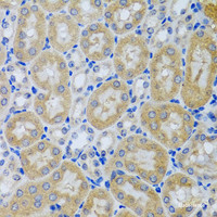 Immunohistochemistry of paraffin-embedded Mouse kidney using ACP1 Polyclonal Antibody at dilution of 1:100 (40x lens) .