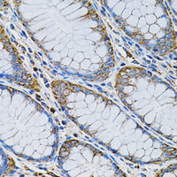 Immunohistochemistry of paraffin-embedded Human colon using ADSS Polyclonal Antibody at dilution of 1:100 (40x lens) .