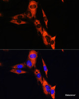 Immunofluorescence analysis of NIH/3T3 cells using ATP1B1 Polyclonal Antibody at dilution of 1:100. Blue: DAPI for nuclear staining.