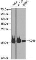 Western blot analysis of extracts of various cell lines using CD59 Polyclonal Antibody at dilution of 1:1000.