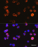 Immunofluorescence analysis of Jurkat cells using CD3E Antigen Polyclonal Antibody at dilution of 1:100. Blue: DAPI for nuclear staining.