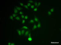 Immunofluorescence analysis of MCF-7 cells using CHAT Polyclonal Antibody