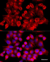 Immunofluorescence analysis of HeLa cells using CLTC Polyclonal Antibody at dilution of 1:100 (40x lens) . Blue: DAPI for nuclear staining.