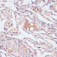 Immunohistochemistry of paraffin-embedded Human lung using IFNG Polyclonal Antibody at dilution of 1:100 (40x lens) .