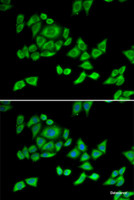 Immunofluorescence analysis of U2OS cells using OGDH Polyclonal Antibody