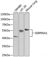 Western blot analysis of extracts of various cell lines using SERPINA1 Polyclonal Antibody at dilution of 1:1000.