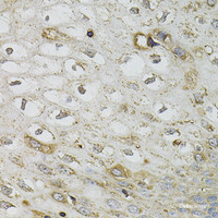 Immunohistochemistry of paraffin-embedded Human esophagus using SERPINA1 Polyclonal Antibody at dilution of 1:100 (40x lens) .