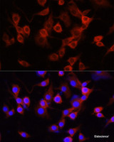 Immunofluorescence analysis of PC-12 cells using SERPINA1 Polyclonal Antibody at dilution of 1:100 (40x lens) . Blue: DAPI for nuclear staining.