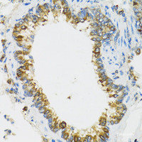 Immunohistochemistry of paraffin-embedded Rat lung using PI3 Polyclonal Antibody at dilution of 1:100 (40x lens) .