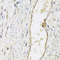 Immunohistochemistry of paraffin-embedded Human esophagus using SELP Polyclonal Antibody