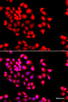 Immunofluorescence analysis of A549 cells using STXBP2 Polyclonal Antibody