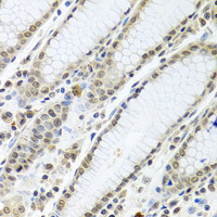 Immunohistochemistry of paraffin-embedded Human stomach using TIA1 Polyclonal Antibody at dilution of 1:100 (40x lens) .