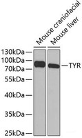 Western blot analysis of extracts of various cell lines using TYR Polyclonal Antibody at dilution of 1:1000.