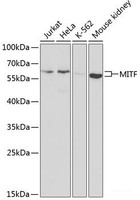 Western blot analysis of extracts of various cell lines using MITF Polyclonal Antibody at dilution of 1:1000.