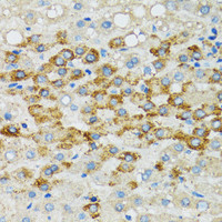 Immunohistochemistry of paraffin-embedded Human liver using Bim Polyclonal Antibody at dilution of 1:100 (40x lens) .