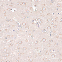Immunohistochemistry of paraffin-embedded Mouse brain using ABCF2 Polyclonal Antibody at dilution of 1:100 (40x lens) .