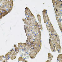 Immunohistochemistry of paraffin-embedded Rat heart using IKBKG Polyclonal Antibody