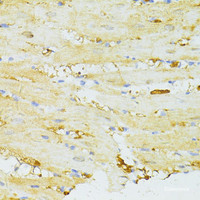 Immunohistochemistry of paraffin-embedded Rat heart using SIRT2 Polyclonal Antibody at dilution of 1:100 (40x lens) .