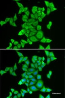 Immunofluorescence analysis of MCF7 cells using STRN3 Polyclonal Antibody