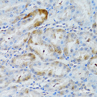 Immunohistochemistry of paraffin-embedded Rat kidney using MOAP1 Polyclonal Antibody at dilution of 1:100 (40x lens) .