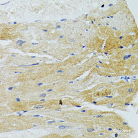 Immunohistochemistry of paraffin-embedded Rat heart using MOAP1 Polyclonal Antibody at dilution of 1:100 (40x lens) .