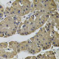 Immunohistochemistry of paraffin-embedded Human stomach using IL33 Polyclonal Antibody