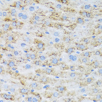 Immunohistochemistry of paraffin-embedded Mouse liver using TIRAP Polyclonal Antibody at dilution of 1:100 (40x lens) .