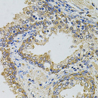 Immunohistochemistry of paraffin-embedded Human prostate using Gm13125 Polyclonal Antibody at dilution of 1:100 (40x lens) .