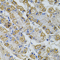 Immunohistochemistry of paraffin-embedded Human stomach using Gm13125 Polyclonal Antibody at dilution of 1:100 (40x lens) .