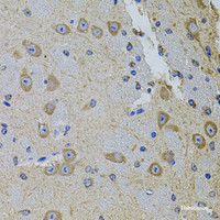 Immunohistochemistry of paraffin-embedded Mouse brain using Gm13125 Polyclonal Antibody at dilution of 1:100 (40x lens) .
