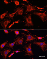 Immunofluorescence analysis of C6 cells using IRAK1 Polyclonal Antibody at dilution of 1:100. Blue: DAPI for nuclear staining.