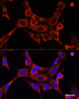 Immunofluorescence analysis of NIH/3T3 cells using IRAK1 Polyclonal Antibody at dilution of 1:100. Blue: DAPI for nuclear staining.