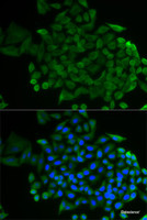 Immunofluorescence analysis of MCF-7 cells using COG2 Polyclonal Antibody