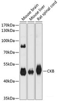 Western blot analysis of extracts of various cell lines using CKB Polyclonal Antibody at dilution of 1:3000.