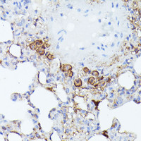 Immunohistochemistry of paraffin-embedded Rat lung using NLRP3 Polyclonal Antibody at dilution of 1:100 (40x lens) .