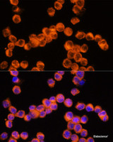 Immunofluorescence analysis of Raw264.7 cells using NLRP3 Polyclonal Antibody at dilution of 1:100. Blue: DAPI for nuclear staining.
