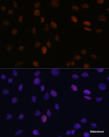 Immunofluorescence analysis of C6 cells using PSME3 Polyclonal Antibody at dilution of 1:100 (40x lens) . Blue: DAPI for nuclear staining.