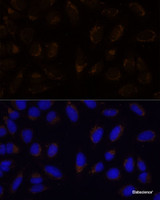 Immunofluorescence analysis of U-2 OS cells using CD133 Polyclonal Antibody at dilution of 1:100. Blue: DAPI for nuclear staining.